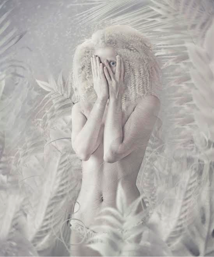 Albino girl in jungle